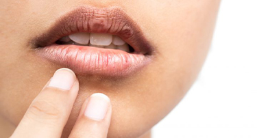 Dental Health and Dry Mouth: Causes, Symptoms and Treatment