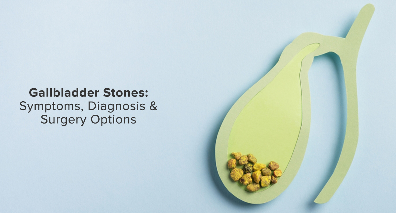Can Gallbladder Stones Be Removed Without Surgery?