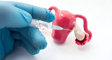 Infertility: Causes, Diagnosis, and Assisted Reproductive Technologies