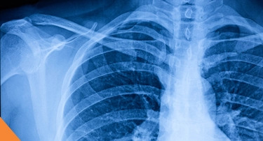 World Radiography Day 2025: Celebrating the Heroes Behind Medical Imaging